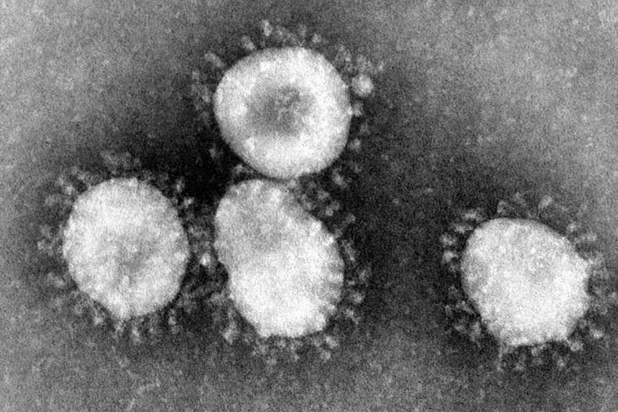 The+Coronavirus+has+taken+the+world+by+storm+in+previous+months.+In+order+to+best+combat+the+spread+of+the+disease%2C+global+leaders+must+work+together%2C+be+transparent+with+information+and+follow+advice+from+experts.+