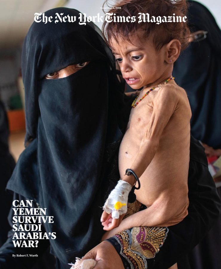 Miriam Hamdan, 20, holds her severely malnourished daughter, Jenna Ali Hatman, 1 and 8 months old, at the therapeutic feeding centre supported by Unicef in Saada, North Yemen. Jenna was sick for past 4 months and just diagnosed with lymphoma. Miriam has already lost one of her three children. September 2018.